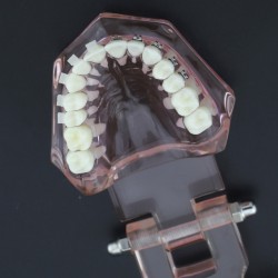 Modèle Orthodontie Contraste des brackets M3009