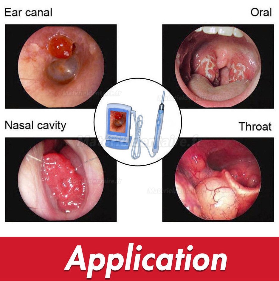 Digital Video Otoscope Endoscope /Sinuscopes avec diamètre de 3.9mm tube imperméable flexible