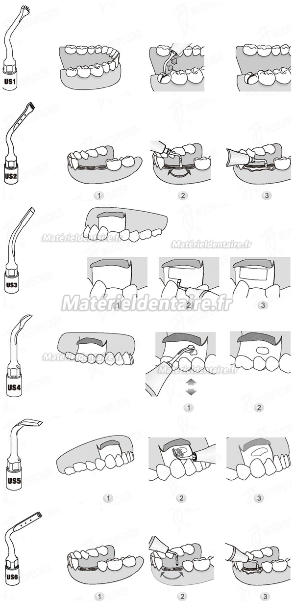 WOODPECKER® INSERTS A PIEZO CHIRURGIE OSTEOTOMY KIT 6 INSERTS