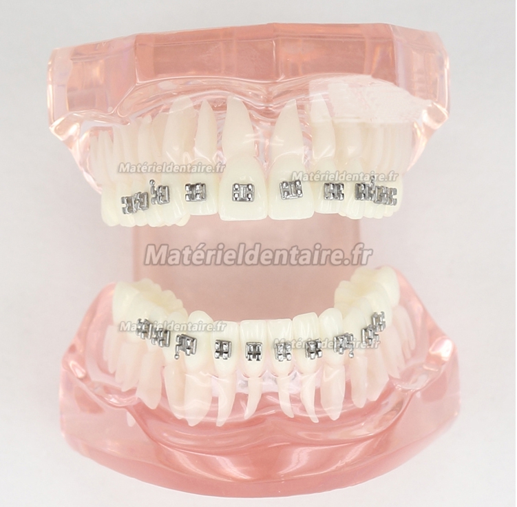 Modèle Malocclusion Correcte avec 20 Brackets M-3001