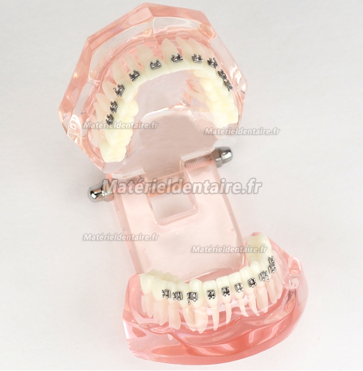 Modèle Malocclusion Correcte avec 20 Brackets M-3001