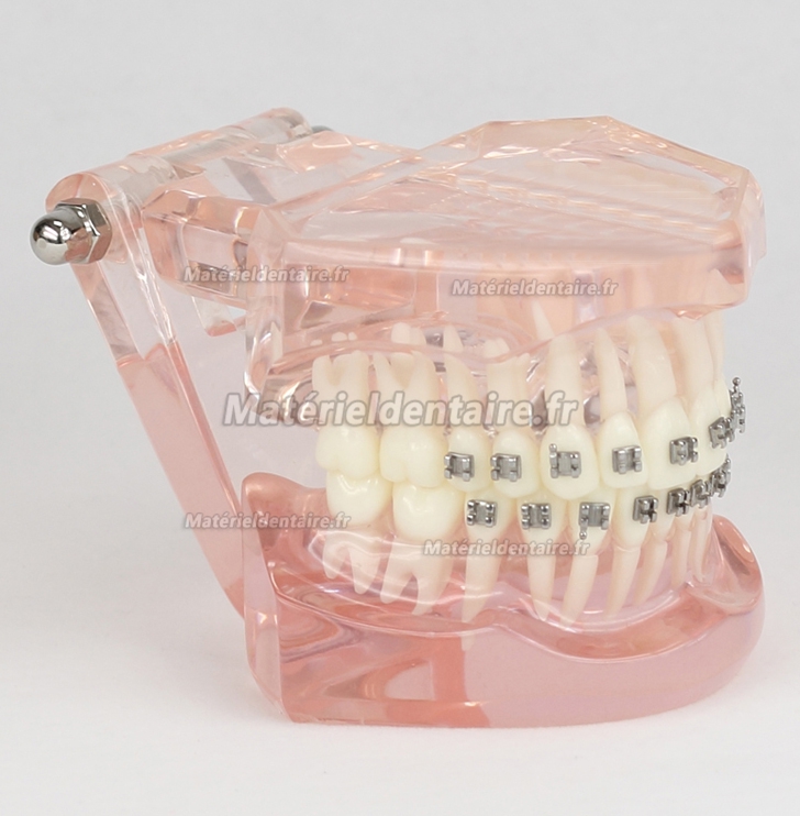 Modèle Malocclusion Correcte avec 20 Brackets M-3001