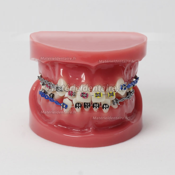 Modèle Orthodontique avec arc externe M-3005