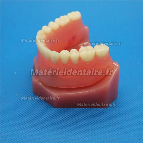 Modèle dentaire pour réparation d’implant dentaire M-6007