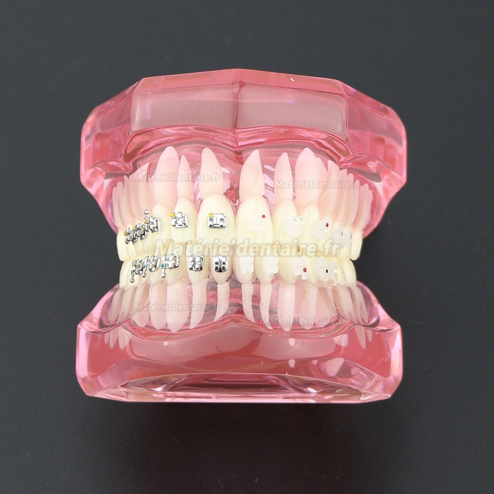 Modèle de Dents Dentaire Orthodontique Bracket métal et céramique étude 3003