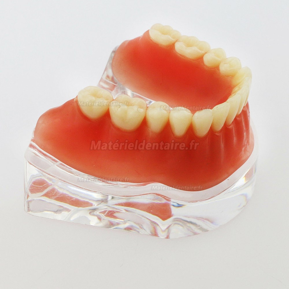 Dentaire inférieur Modèle de dents Overdenture Précision 4 implants Manifestation Bar d'Argent