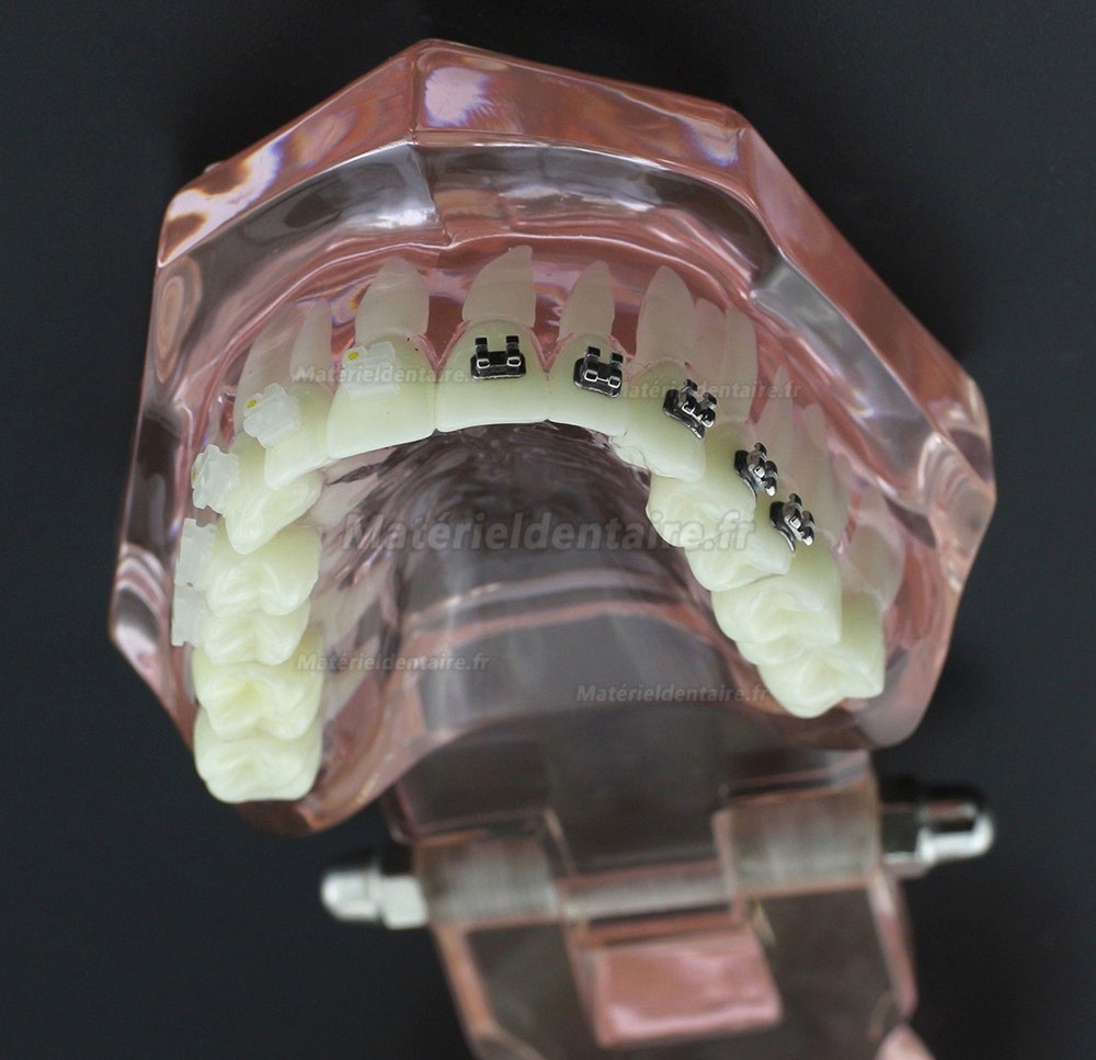 Modèle Orthodontie Contraste des brackets M3009