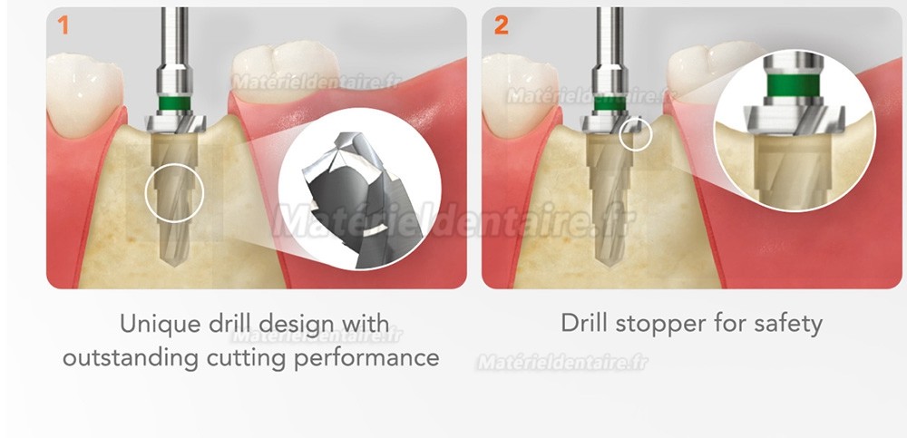 Kit chirurgical cône Osstem Hiossen avec clé dynamométrique (à utiliser pour TSⅢ/Ⅳ SSⅢ USⅢ/Ⅳ)