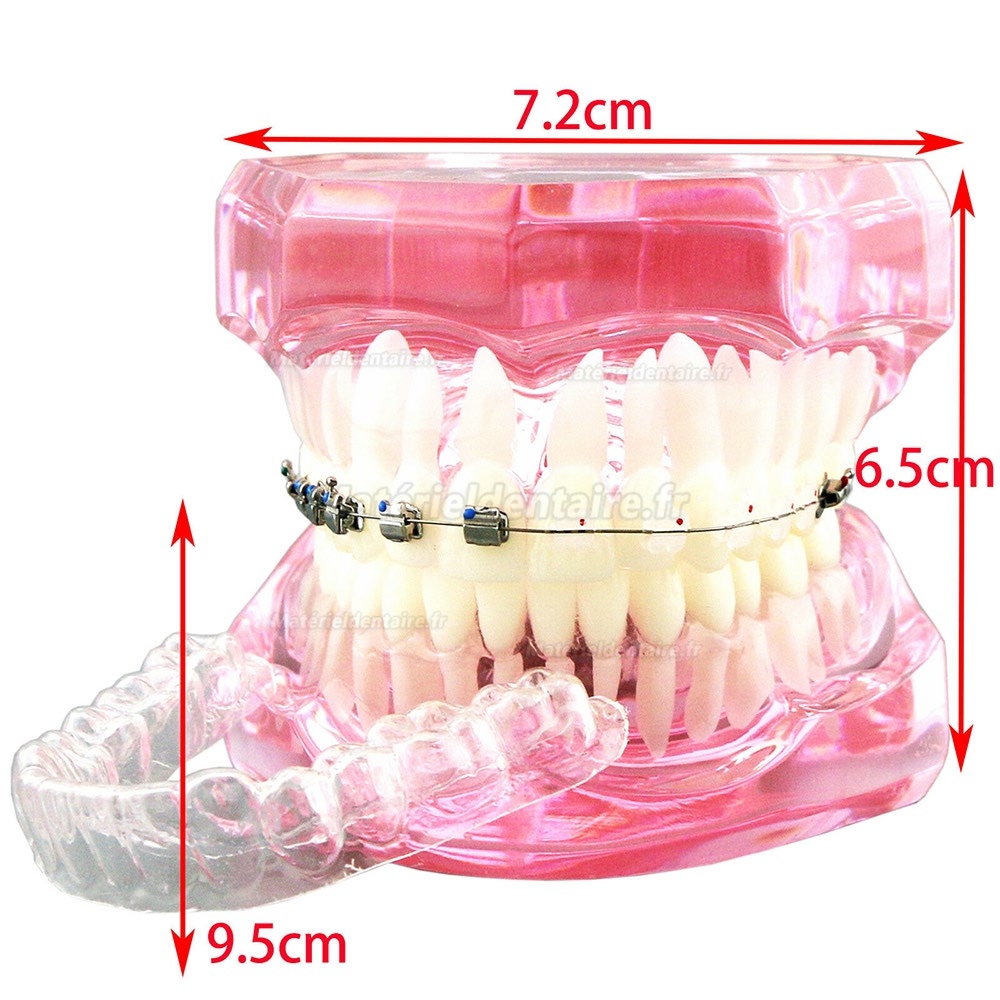 Modèle de dents orthodontiques dentaires + Chaîne auto-ligaturante pour tube de support en céramique et métal