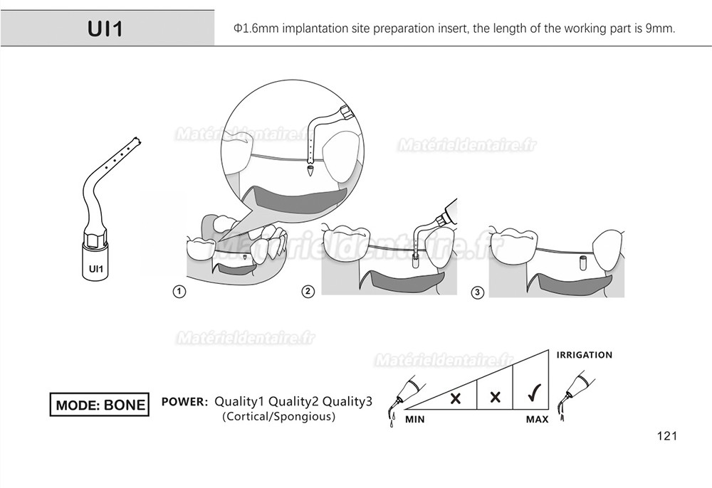 1 Pièces Inserts pour sinus lift latéral Ul1 UI2 UI3 UI4 UI5 compatible avec Mectron Woodpecker Silfradent Dmetec