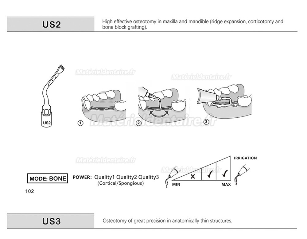 1 Pièces Inserts piezosurgery pour la chirurgie osseuse US1 US1L US1R US2 US3 US4 US5 US6 US7 US11 US12 compatible avec Mectron Silfradent Dmetec Woodpecker