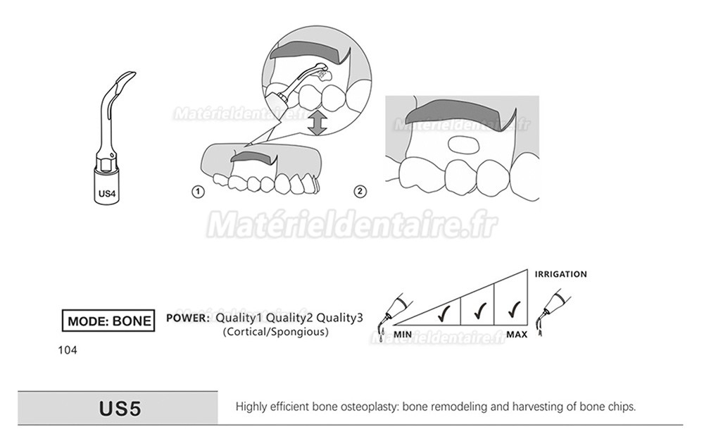 1 Pièces Inserts piezosurgery pour la chirurgie osseuse US1 US1L US1R US2 US3 US4 US5 US6 US7 US11 US12 compatible avec Mectron Silfradent Dmetec Woodpecker