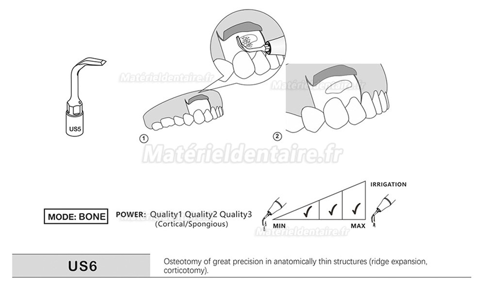 1 Pièces Inserts piezosurgery pour la chirurgie osseuse US1 US1L US1R US2 US3 US4 US5 US6 US7 US11 US12 compatible avec Mectron Silfradent Dmetec Woodpecker