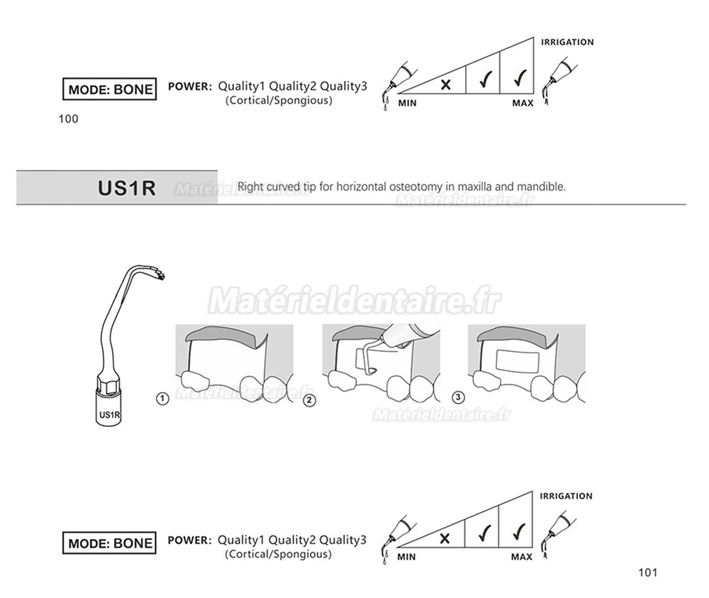 1 Pièces Inserts piezosurgery pour la chirurgie osseuse US1 US1L US1R US2 US3 US4 US5 US6 US7 US11 US12 compatible avec Mectron Silfradent Dmetec Woodpecker