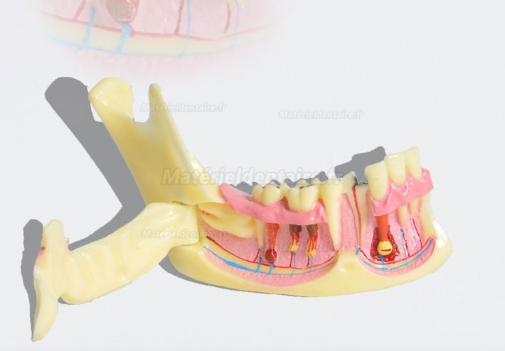 Modèle anatomique dentaire de décomposition du tissu osseux frontal inférieur