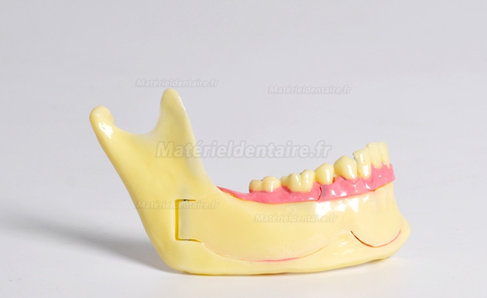 Modèle anatomique dentaire de décomposition du tissu osseux frontal inférieur