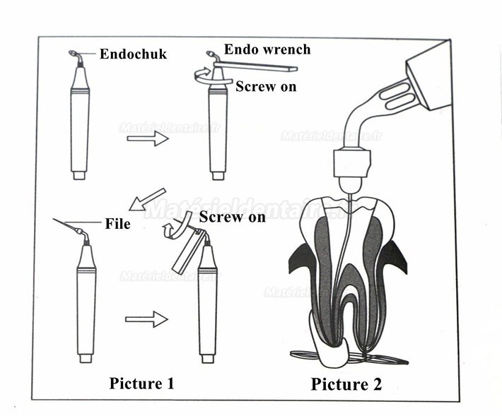 TW-E1 Pointe E1 E2 Clé de NITI K Kit Dentaire de Canal Radiculaire Endodontique de Woodpecker